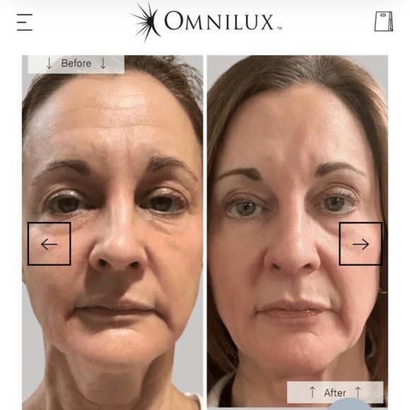Omnilux Contour Face Mask - Picture 7 of 9